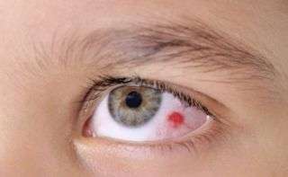 Accidentes mas frecuentes al aire libre