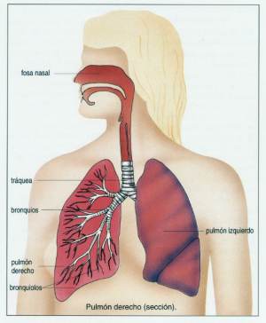 BRONQUITIS