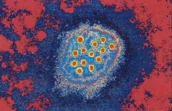 HEPATITIS