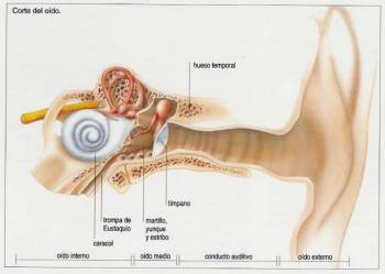 OTITIS