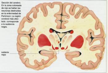 PARKINSON