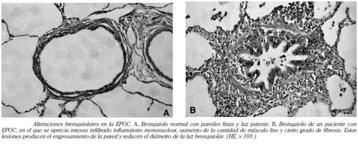 ANATOMÍA PATOLÓGICA