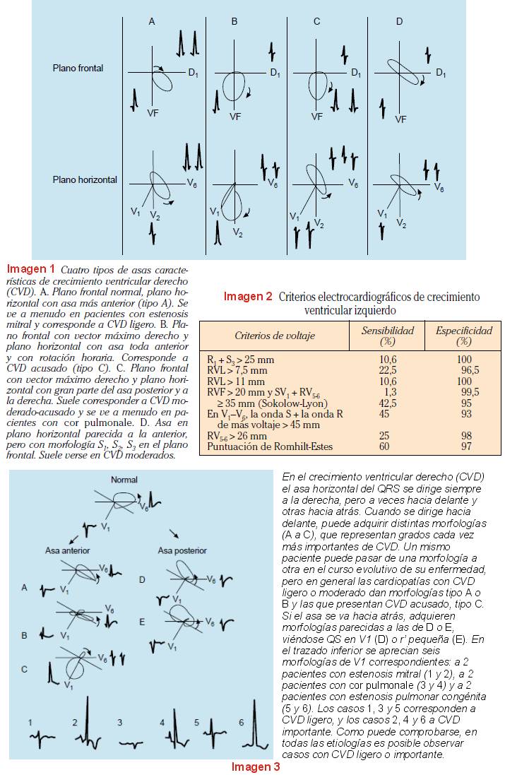CRECIMIENTO VENTRICULAR