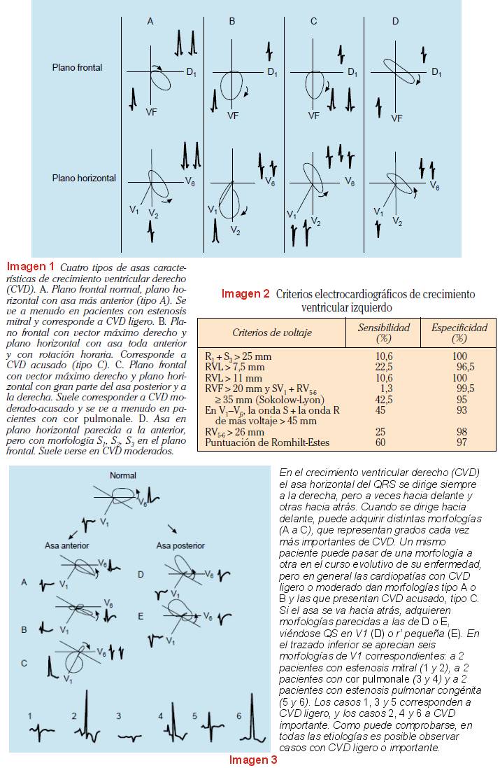 CRECIMIENTO VENTRICULAR