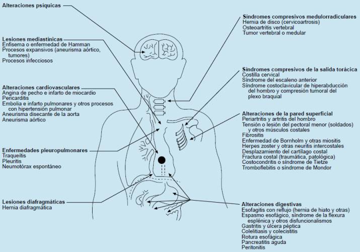 EMBOLIA PULMONAR