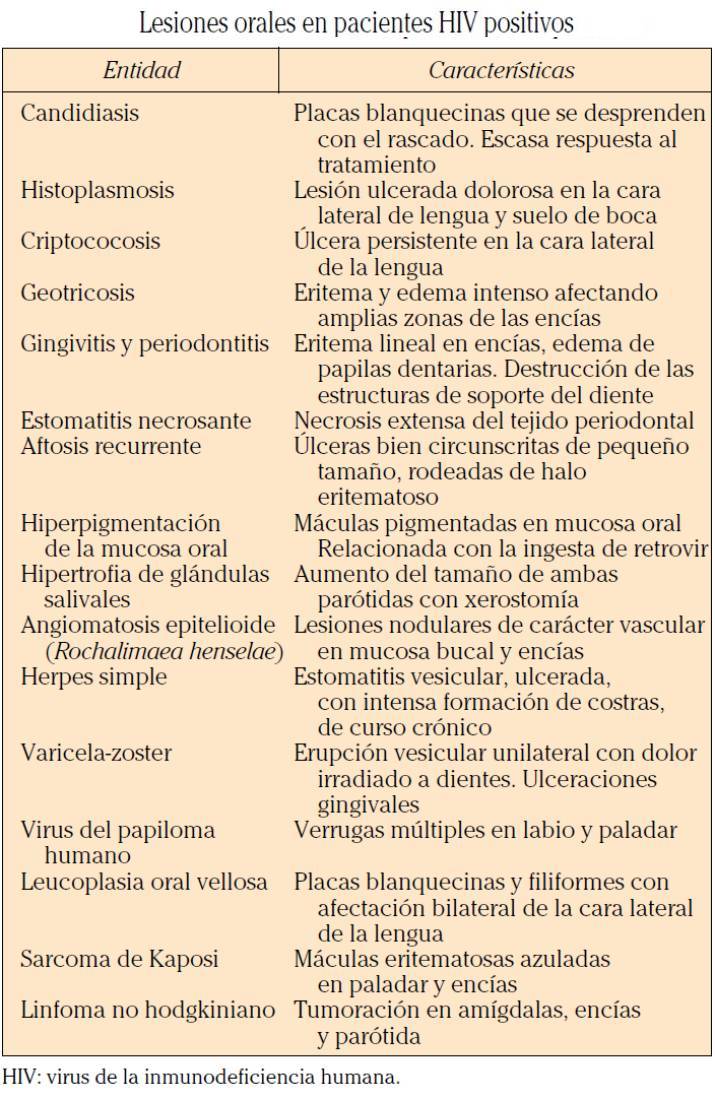 VIRUS INMUNODEFICIENCIA HUMANA